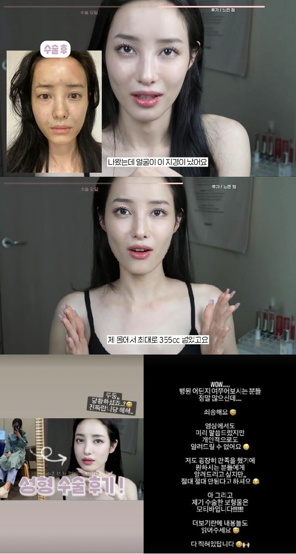 유깻잎, 가슴 성형 고백